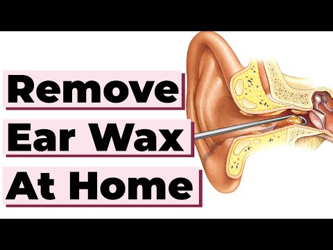 how to eliminate ear wax