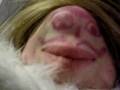 Morice