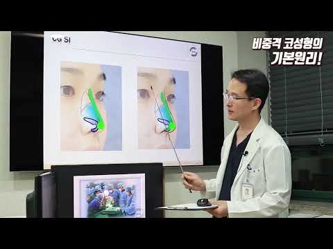 비중격코성형의 기본원리 (비중격연골 코수술)