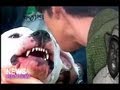 Kyle Dyer, KUSA Anchor In Denver, Bit On The Face ...
