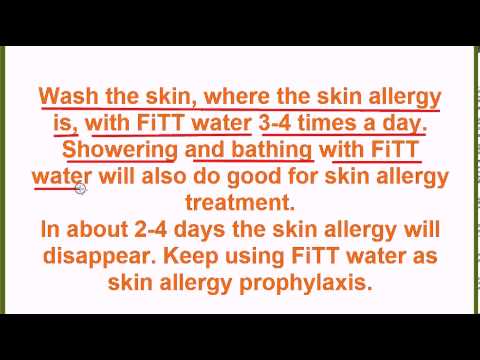 how to cure skin allergy