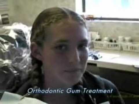 Laser Dentistry