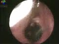 resdung makan belacan - free flv video @ vwatch.tv