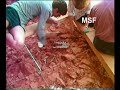 los yacimientos de la sierra de atapuerca 1ª parte