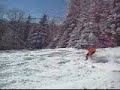 Dan toppin the bumps