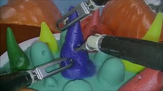 軟性内視鏡とロボ技術で外科治療　慶大が新手術法（動画あり）