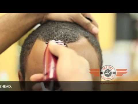 how to get rid of a v shaped hairline