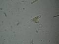 Jittery Spirochete Also Leads A Busy Life