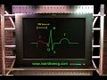 Learn the ECG - PR Interval Learn the ECG - PR Interval
