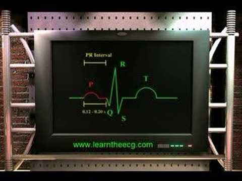 how to measure the p-r interval