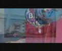 2007 Video Krabbe Disease