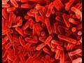 videos de Staph and MRSA