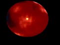 Oort Cloud