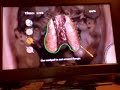 Bully SE - Biology 5