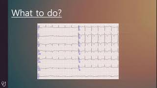 STEMI equivalent 너도 빨리 보라고! - 정의기