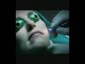 Eliminar las manchas del rostro