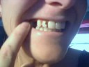 Re: Need a Pro-Bono Dentist Re: Need a Pro-Bono Dentist