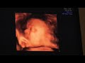 Lillasyster vecka 31+1