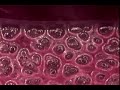 Alveolar recruitment Alveolar recruitment