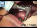 dental-implants.html