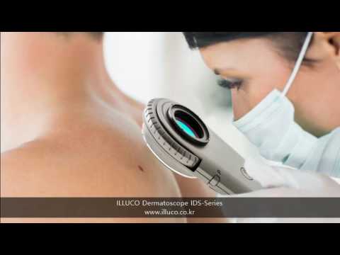 ILLUCO IDS Dermatoscope Series