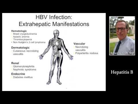 how to get rid of hepatitis b