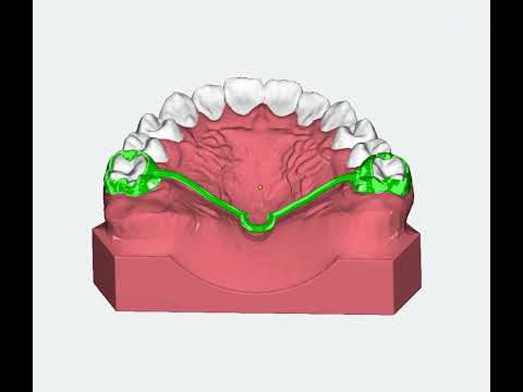 TPA Digital bei Dento Lab