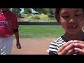 Loose Tooth Pulled by Home Run Hitter