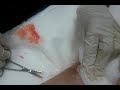 Gross you have to see this