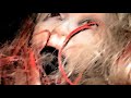 Electronic Voice Phenomenon Electronic Voice Phenomenon