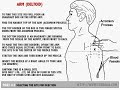 How to inject IM: Selecting The Site For Injection