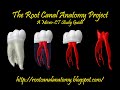 Maxillary Third Molar 01