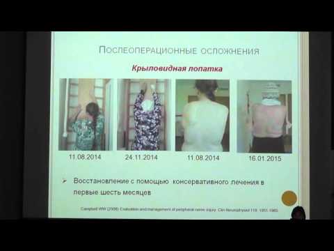 Доклад специалиста по физической реабилитации LISOD Елены Беловой «Комплексная постхирургическая реабилитация пациентов с раком молочной железы». Украина.