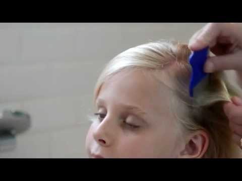 how to apply ulesfia