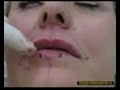 embelezamento labial
