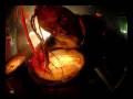 videos de Mushroomhead - Damage Done
