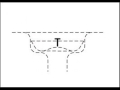 New invention: Chokeless sink strainer New invention: Chokeless sink strainer