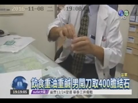 105 11 08華視:客家菜重口味客家庄膽結石元凶?