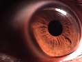 Best Eyeball Close-Up EVER!