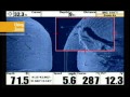 Side Imaging Zoom and Coverage Adjustments