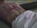 La Passione di Cristo (2005) [Crucifixion]