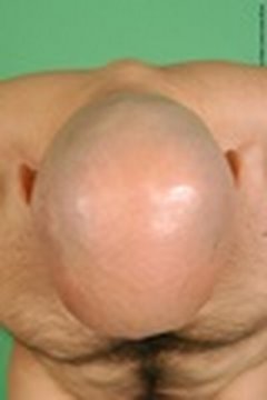 Does Scalp massage regrow hair? 0 Does Scalp massage regrow hair?