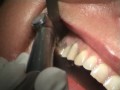 /WAMkey Video 5