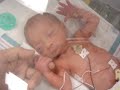 krismaris little hand  2nd day after birth: 