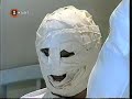 al darse cuenta de que la persona que atendia en el hospital era ricardo ,conchola prepara una terrible venganza