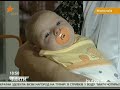 Видеоновость Николаев. Ребенок родился без ручек и ножки | Врачи не увидели патологий на УЗИ | Ужасная халатность