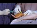 videos de Amala Cardiac Centre,Thrissur,Kerala