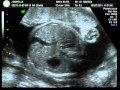 Nosso filho � muito lindo!!! 28 semanas