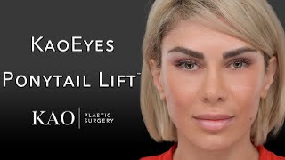 This is NOT A Thread Lift and NOT a Facelift! Ponytail Lift™ with KaoEyes - Fox Eye Plastic Surgery