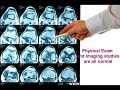 Knee pain from Exertion by Dr Farshchian